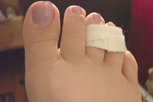 again_with_the_broken_toe.jpg